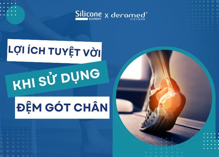 4 lợi ích tuyệt vời khi sử dụng đệm gót chân Deramed