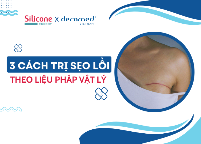 3 cách trị sẹo lồi theo liệu pháp vật lý được khuyến nghị