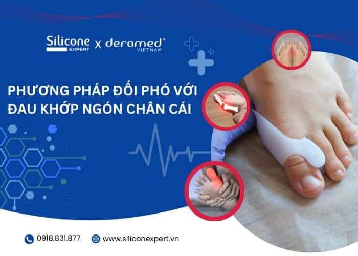 Phương pháp đối phó hiệu quả với đau khớp ngón chân cái