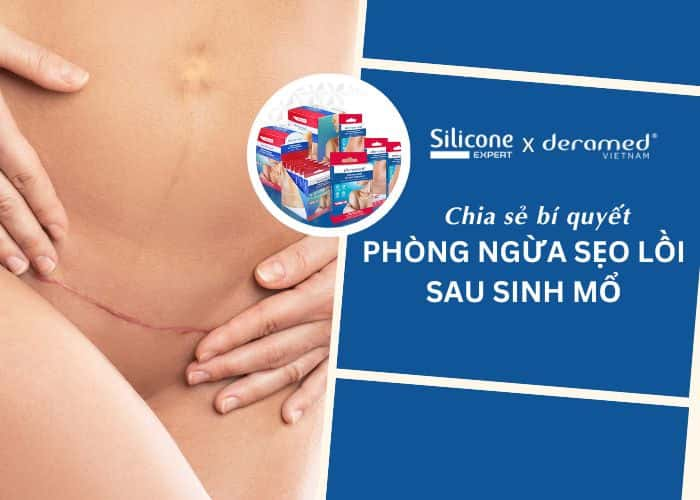 Chia sẻ 3 bí quyết giúp phòng ngừa sẹo lồi sau sinh mổ