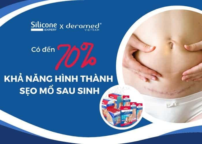 Khả năng hình thành sẹo mổ sau sinh chiếm tỷ lệ lên đến 70%