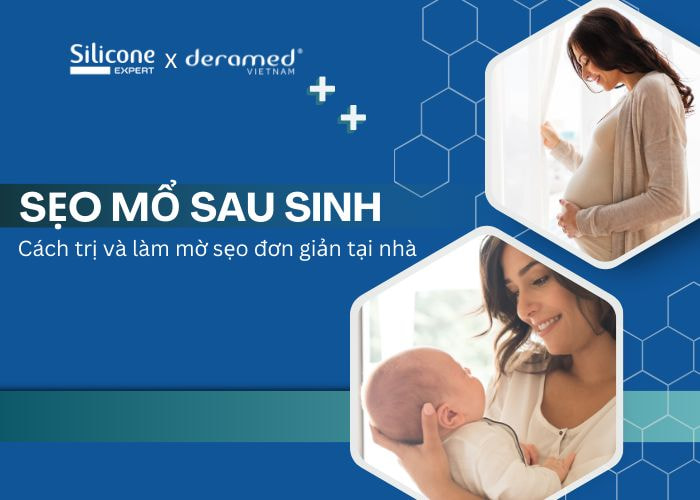 Sẹo mổ sau sinh: Cách trị và làm mờ đơn giản tại nhà