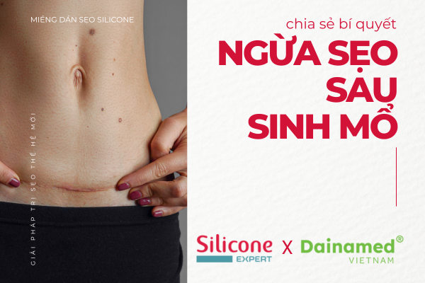 Chia sẻ 3 bí quyết giúp phòng ngừa sẹo lồi sau sinh mổ