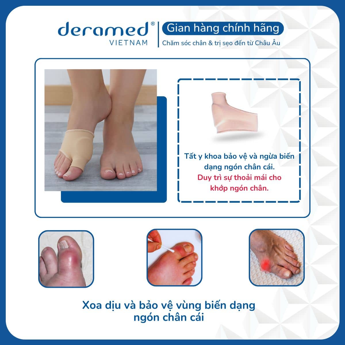 tat_bao_ve_ngon_cai_bien_dang_3_Deramed_Vietnam