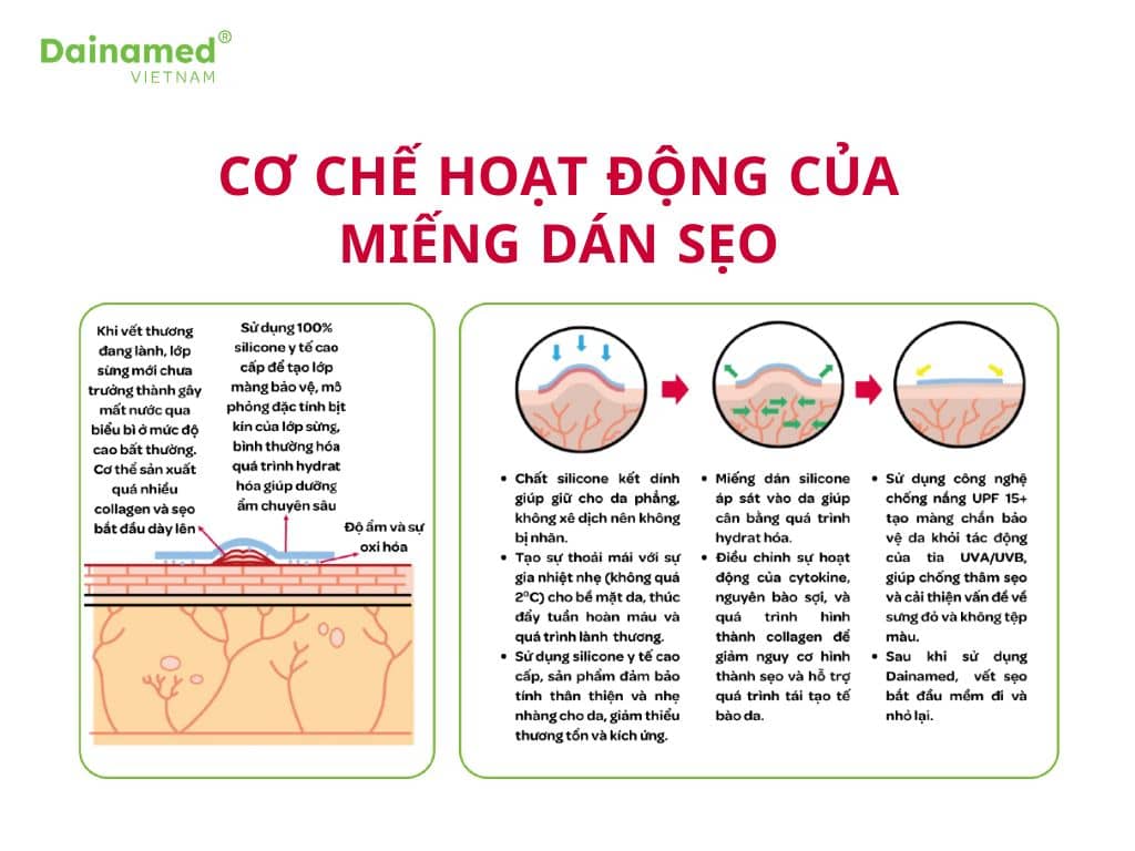 Cơ chế hình thành sẹo lồi/ sẹo phì đại từ Miếng dán silicone trị sẹo Dainamed.