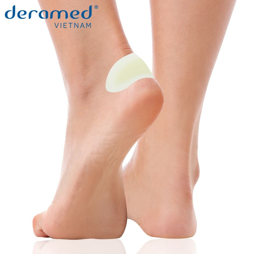 Miếng dán điều trị phồng rộp chứa thành phần Hydrocolloid